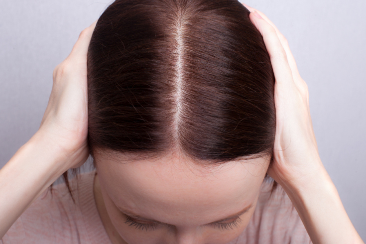 Causes of hair loss in women after 40