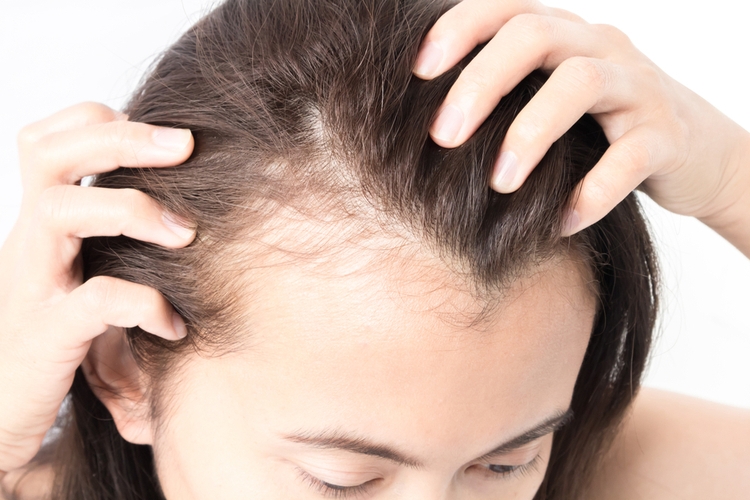 Folk remedies for hair loss in women at home