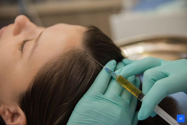 Ozone therapy for the scalp