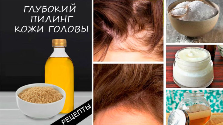 How to clean your scalp at home