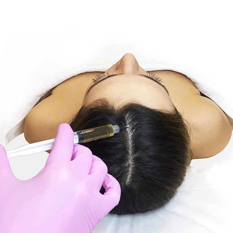 All about hair mesotherapy